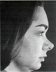 face with nose tilted up